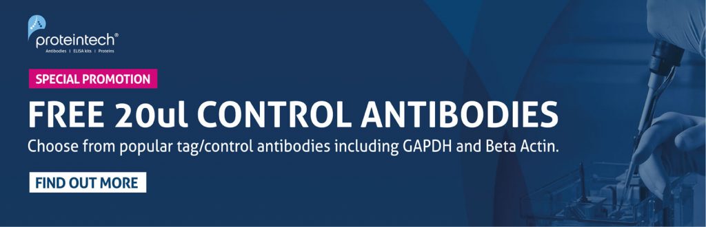control; antibodies, ProteinTech, sampling, muestras, anticuerpos, control, western blot, IHC, promoción, oferta, promoion, offer
